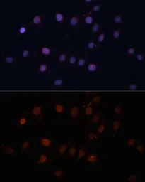 Anti-TOM70 antibody used in Immunocytochemistry/ Immunofluorescence (ICC/IF). GTX32929
