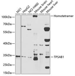Anti-Mast cell tryptase antibody used in Western Blot (WB). GTX32931