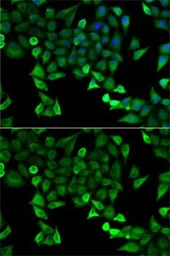 Anti-Mast cell tryptase antibody used in Immunocytochemistry/ Immunofluorescence (ICC/IF). GTX32931