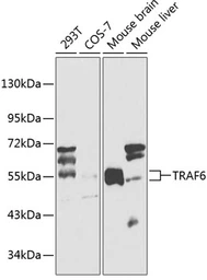 Anti-TRAF6 antibody used in Western Blot (WB). GTX32932