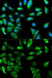 Anti-TRAF6 antibody used in Immunocytochemistry/ Immunofluorescence (ICC/IF). GTX32932