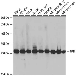 Anti-Triosephosphate isomerase antibody used in Western Blot (WB). GTX32936