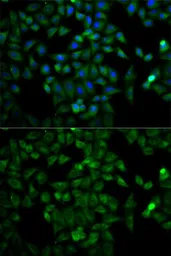 Anti-Triosephosphate isomerase antibody used in Immunocytochemistry/ Immunofluorescence (ICC/IF). GTX32936
