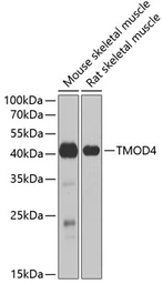 Anti-Tropomodulin 4 antibody used in Western Blot (WB). GTX32937