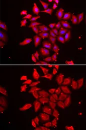 Anti-Tropomodulin 4 antibody used in Immunocytochemistry/ Immunofluorescence (ICC/IF). GTX32937