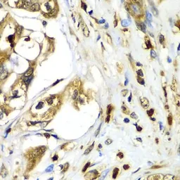 Anti-Tropomodulin 4 antibody used in IHC (Paraffin sections) (IHC-P). GTX32937