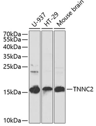Anti-Troponin C fast skeletal antibody used in Western Blot (WB). GTX32938