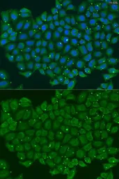 Anti-Troponin C fast skeletal antibody used in Immunocytochemistry/ Immunofluorescence (ICC/IF). GTX32938