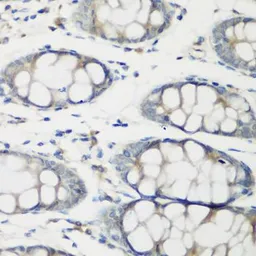 Anti-Troponin C fast skeletal antibody used in IHC (Paraffin sections) (IHC-P). GTX32938