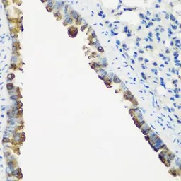Anti-Troponin C fast skeletal antibody used in IHC (Paraffin sections) (IHC-P). GTX32938