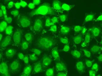 Anti-TSEN2 antibody used in Immunocytochemistry/ Immunofluorescence (ICC/IF). GTX32940