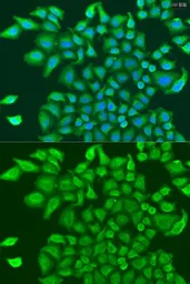 Anti-TUBGCP3 antibody used in Immunocytochemistry/ Immunofluorescence (ICC/IF). GTX32942