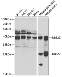 Anti-UBE2Z antibody used in Western Blot (WB). GTX32945