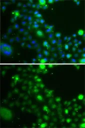 Anti-UBE2Z antibody used in Immunocytochemistry/ Immunofluorescence (ICC/IF). GTX32945
