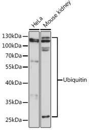 Anti-Ubiquitin B antibody used in Western Blot (WB). GTX32946