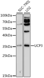 Anti-UCP3 antibody used in Western Blot (WB). GTX32947