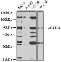 Anti-UGT1A4 antibody used in Western Blot (WB). GTX32949