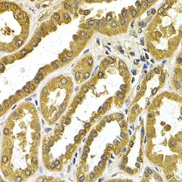 Anti-UGT1A4 antibody used in IHC (Paraffin sections) (IHC-P). GTX32949
