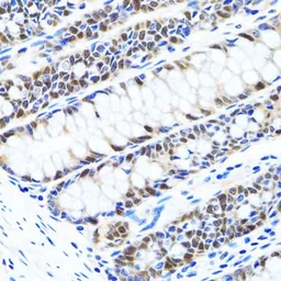 Anti-UHRF1 antibody used in IHC (Paraffin sections) (IHC-P). GTX32951