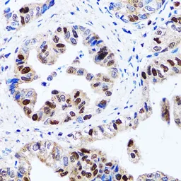 Anti-UHRF1 antibody used in IHC (Paraffin sections) (IHC-P). GTX32951