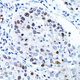 Anti-UHRF1 antibody used in IHC (Paraffin sections) (IHC-P). GTX32951