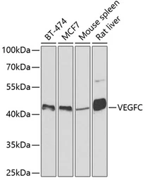 Anti-VEGFC antibody used in Western Blot (WB). GTX32962