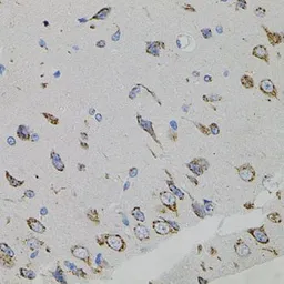 Anti-VEGFC antibody used in IHC (Paraffin sections) (IHC-P). GTX32962