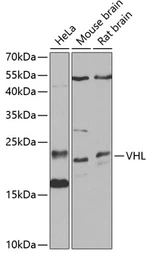 Anti-Von Hippel Lindau antibody used in Western Blot (WB). GTX32968