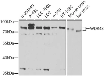 Anti-WDR48 antibody used in Western Blot (WB). GTX32970