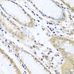 Anti-WDR48 antibody used in IHC (Paraffin sections) (IHC-P). GTX32970