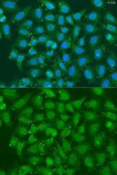 Anti-XBP1 antibody used in Immunocytochemistry/ Immunofluorescence (ICC/IF). GTX32974