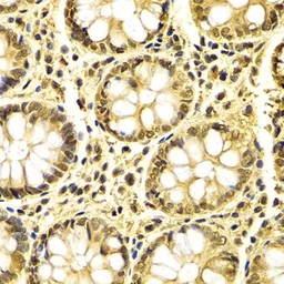 Anti-XRCC3 antibody used in IHC (Paraffin sections) (IHC-P). GTX32975