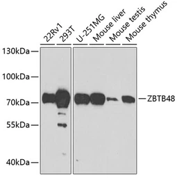 Anti-ZBTB48 antibody used in Western Blot (WB). GTX32978