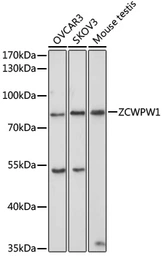 Anti-ZCWPW1 antibody used in Western Blot (WB). GTX32979