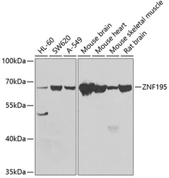 Anti-ZNF195 antibody used in Western Blot (WB). GTX32980