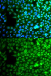 Anti-ZNF195 antibody used in Immunocytochemistry/ Immunofluorescence (ICC/IF). GTX32980