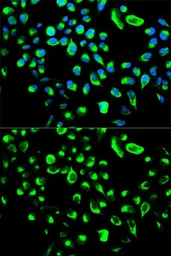 Anti-14-3-3 theta antibody used in Immunocytochemistry/ Immunofluorescence (ICC/IF). GTX32983