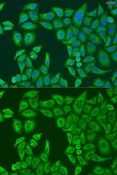 Anti-ABCF2 antibody used in Immunocytochemistry/ Immunofluorescence (ICC/IF). GTX32985
