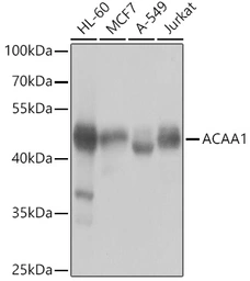Anti-ACAA1 antibody used in Western Blot (WB). GTX32986