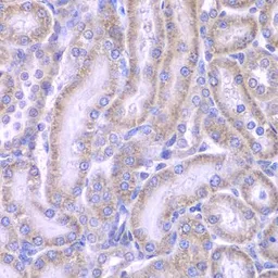 Anti-ACAA1 antibody used in IHC (Paraffin sections) (IHC-P). GTX32986