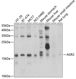 Anti-Anterior Gradient 2 antibody used in Western Blot (WB). GTX32995