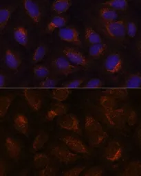 Anti-Anterior Gradient 2 antibody used in Immunocytochemistry/ Immunofluorescence (ICC/IF). GTX32995