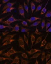 Anti-Anterior Gradient 2 antibody used in Immunocytochemistry/ Immunofluorescence (ICC/IF). GTX32995