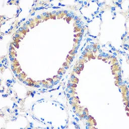 Anti-Anterior Gradient 2 antibody used in IHC (Paraffin sections) (IHC-P). GTX32995