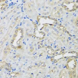 Anti-AHCYL1 antibody used in IHC (Paraffin sections) (IHC-P). GTX32996