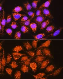 Anti-ALDH1B1 antibody used in Immunocytochemistry/ Immunofluorescence (ICC/IF). GTX32998