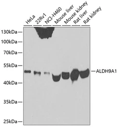 Anti-ALDH9A1 antibody used in Western Blot (WB). GTX33000