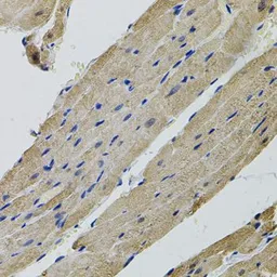Anti-ALDH9A1 antibody used in IHC (Paraffin sections) (IHC-P). GTX33000