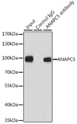Anti-APC5 antibody used in Immunoprecipitation (IP). GTX33008