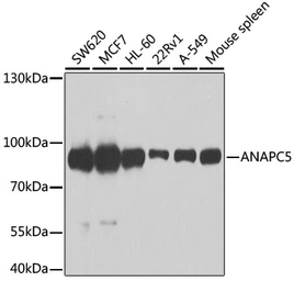 Anti-APC5 antibody used in Western Blot (WB). GTX33008